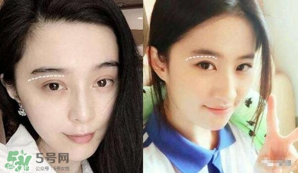 割雙眼皮有幾種做法？雙眼皮有哪幾種形狀？