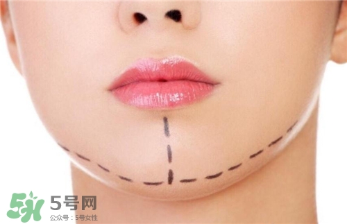 玻尿酸墊下巴能維持多久？玻尿酸墊下巴能維持多長(zhǎng)時(shí)間？