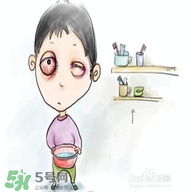 紅眼病是怎么引起的？紅眼病怎么產(chǎn)生的