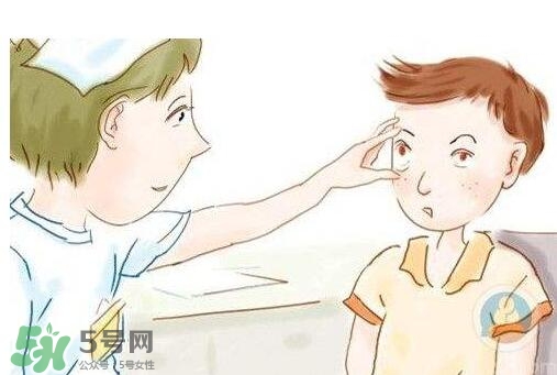 紅眼病用什么眼藥水好？紅眼病吃什么好得快