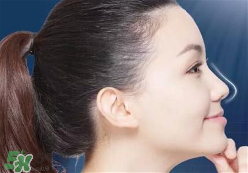 隆鼻會拉近眼距嗎？隆鼻會改變眼睛嗎？
