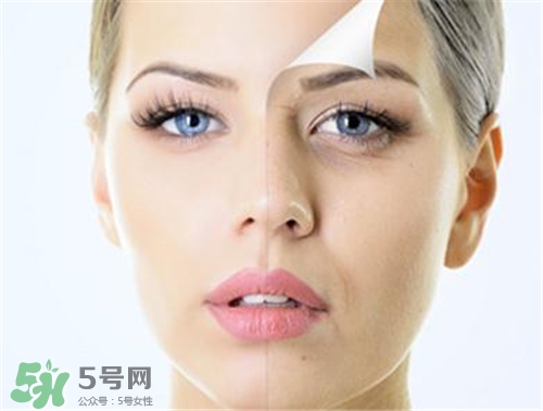 玻尿酸除皺有效果嗎？玻尿酸除皺效果怎么樣？