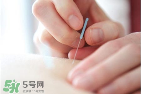 沒病可以針灸嗎？沒病可以扎針嗎？