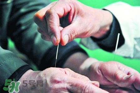 沒病可以針灸嗎？沒病可以扎針嗎？