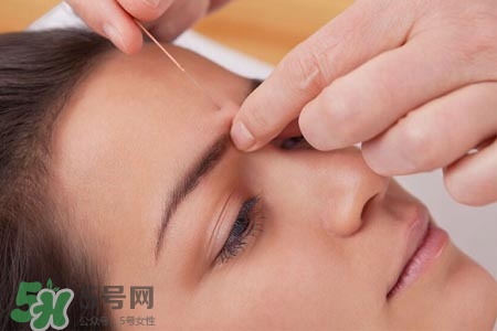 沒病可以針灸嗎？沒病可以扎針嗎？