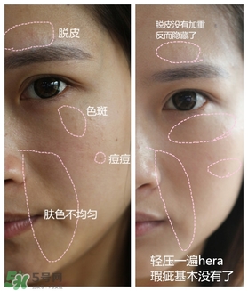 赫拉氣墊用了悶痘嗎？赫拉氣墊悶痘怎么辦？