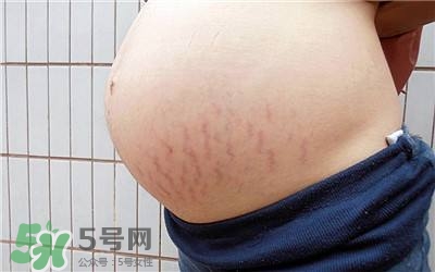 妊娠紋幾個月開始出現(xiàn)？妊娠紋能消除掉嗎？