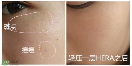 赫拉氣墊用了悶痘嗎？赫拉氣墊悶痘怎么辦？