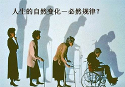 哪些人容易得骨質(zhì)疏松癥？骨質(zhì)疏松的高發(fā)人群有哪些？