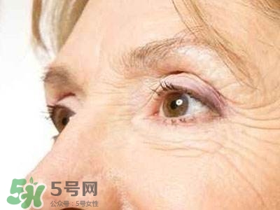 老年斑是怎么形成的？老年斑的形成原因
