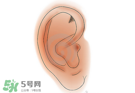 中耳炎有什么癥狀？中耳炎的癥狀表現(xiàn)