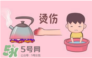 燙傷可以用牙膏嗎？燙傷用牙膏管用嗎？