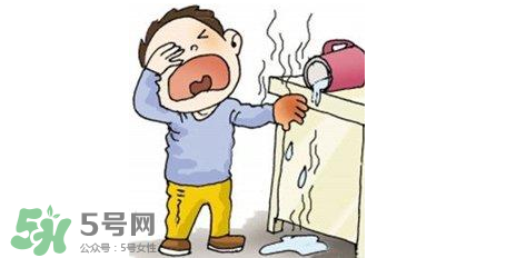 燙傷可以用牙膏嗎？燙傷用牙膏管用嗎？