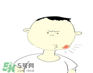 嘴角起泡是什么原因？嘴角起泡怎么辦？