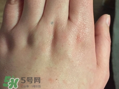 薇諾娜適合什么皮膚？薇諾娜適合敏感肌嗎？