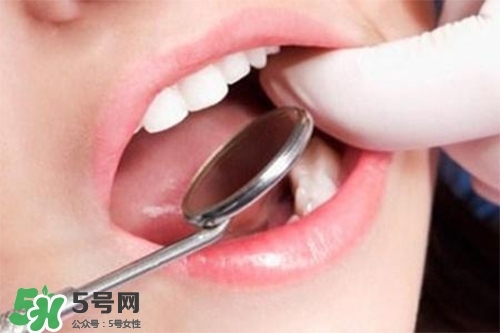 口腔異味是怎么回事？口腔異味怎么清除？
