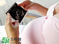 保胎期間可以洗澡嗎？臥床保胎可以洗澡嗎？