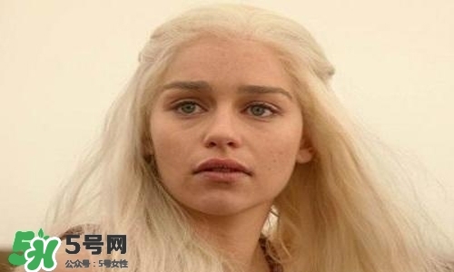 臉色發(fā)黃是什么原因？臉色發(fā)黃吃什么調(diào)理更好？
