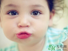孕期可以激光祛斑嗎？懷孕了能做激光祛斑嗎？