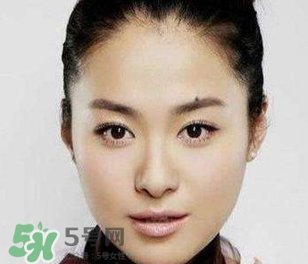 如何預(yù)防臉上長(zhǎng)痣？怎樣預(yù)防臉上長(zhǎng)痣