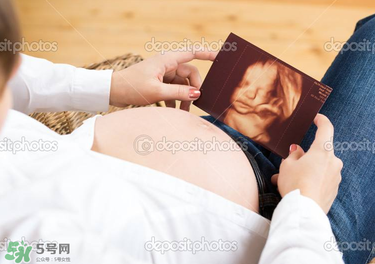 橄欖油真的可以預(yù)防妊娠紋嗎？橄欖油真的可以去妊娠紋嗎？