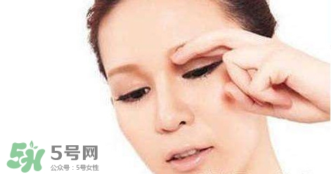 怎樣祛除眼底細紋？如何去除眼底細紋