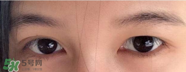 眼睛發(fā)黃是怎么回事？眼睛發(fā)黃是什么原因