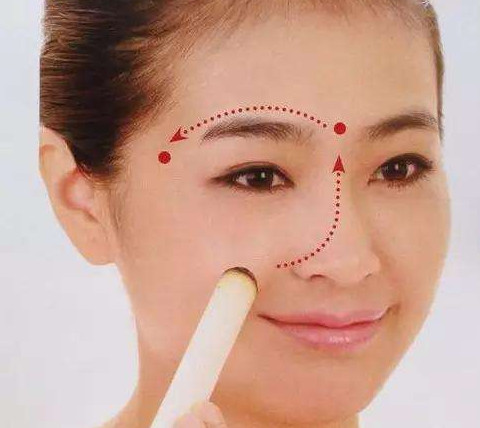 艾灸可以去黑眼圈嗎？艾灸可不可以去黑眼圈