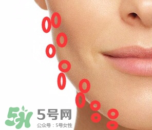 nuface美容儀有效嗎？nuface美容儀副作用？