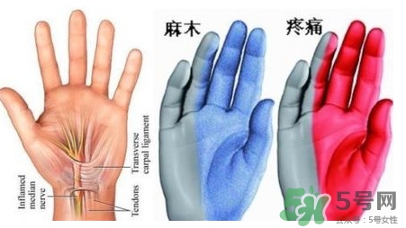 手腳發(fā)麻是缺鈣嗎？手腳發(fā)麻是不是缺鈣