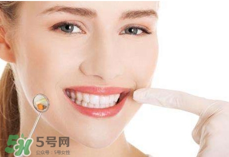 如何去掉牙結(jié)石？牙結(jié)石怎么去除