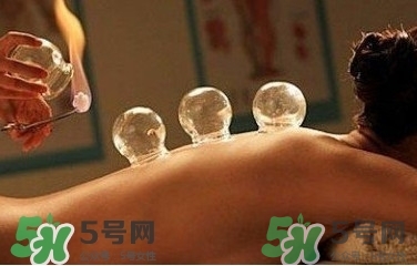 拔火罐疼嗎？拔火罐疼不疼