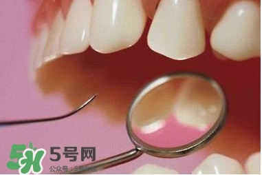 牙周炎傳染嗎？牙周炎會不會傳染