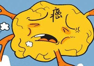 胃癌是怎么引起的？胃癌的早起癥狀