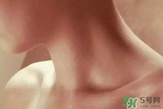 頸椎老化是什么??？頸椎老化的癥狀