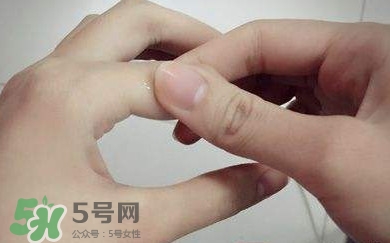 痛風有什么癥狀？女性痛風的初期癥狀