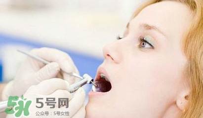 牙齒松動(dòng)能自己恢復(fù)嗎？牙齒松動(dòng)會(huì)自己恢復(fù)嗎