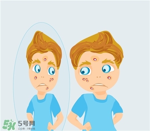 得了痤瘡飲食注意什么？有痤瘡吃東西注意什么