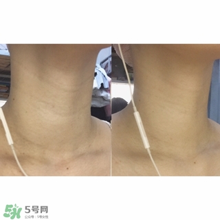 悅薇適合什么年齡？資生堂悅薇適合年齡段