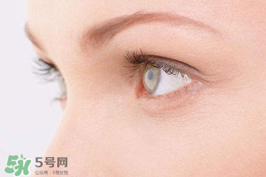眼睛布滿血絲怎么回事？眼睛布滿血絲怎么辦