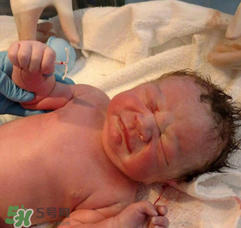 新生兒手握避孕環(huán)出生是怎么回事？出生后健康嗎？