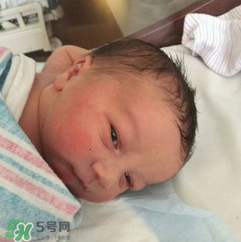 新生兒手握避孕環(huán)出生是怎么回事？出生后健康嗎？