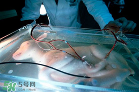 人造子宮能生孩子嗎？人造子宮成功案例
