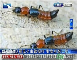 隱翅蟲有毒嗎？隱翅蟲會毀容嗎？