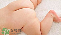 尿布疹怎么辦？寶寶尿布疹擦什么藥好？