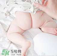 尿布疹和濕疹的區(qū)別 尿布疹和濕疹如何區(qū)分？