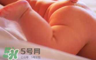 寶寶尿布疹可以擦紅霉素軟膏嗎？紅霉素軟膏對尿布疹有效嗎？