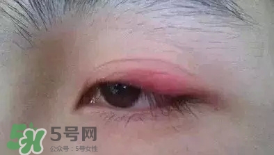 長(zhǎng)期用假睫毛雙眼皮貼對(duì)眼睛有什么傷害？