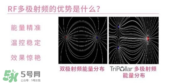 tripollar stop怎么樣？tripollar pose好用嗎