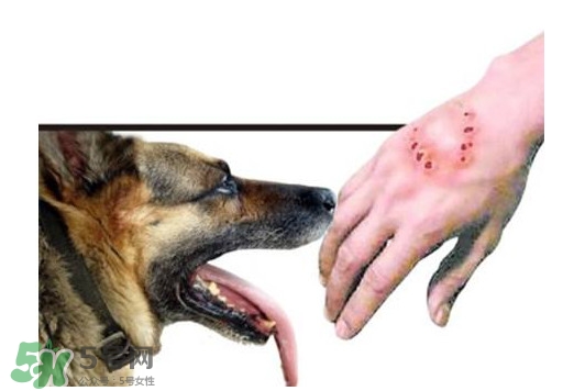 狂犬病會傳染嗎？狂犬病會學(xué)狗叫嗎